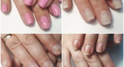 Подолог,мастер медицинского аппаратного педикюра