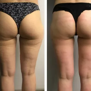 Масаж для здоров’я і задоволення.