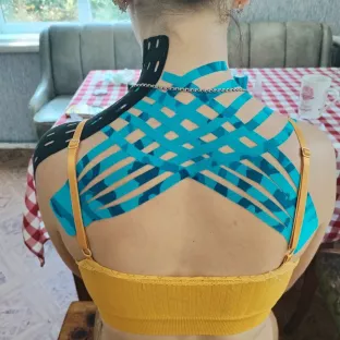 Тейпування