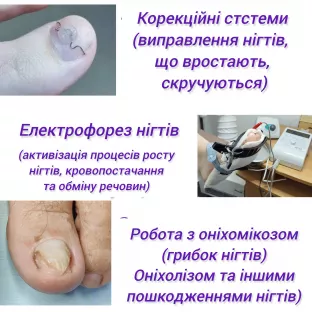 подологія, манікюр, педикюр