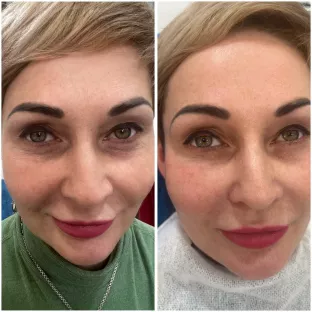 Роботи До та Після 